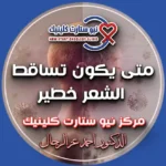 متى يكون تساقط الشعر خطير