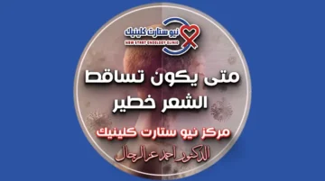 متى يكون تساقط الشعر خطير