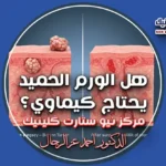 هل الورم الحميد يحتاج كيماوي