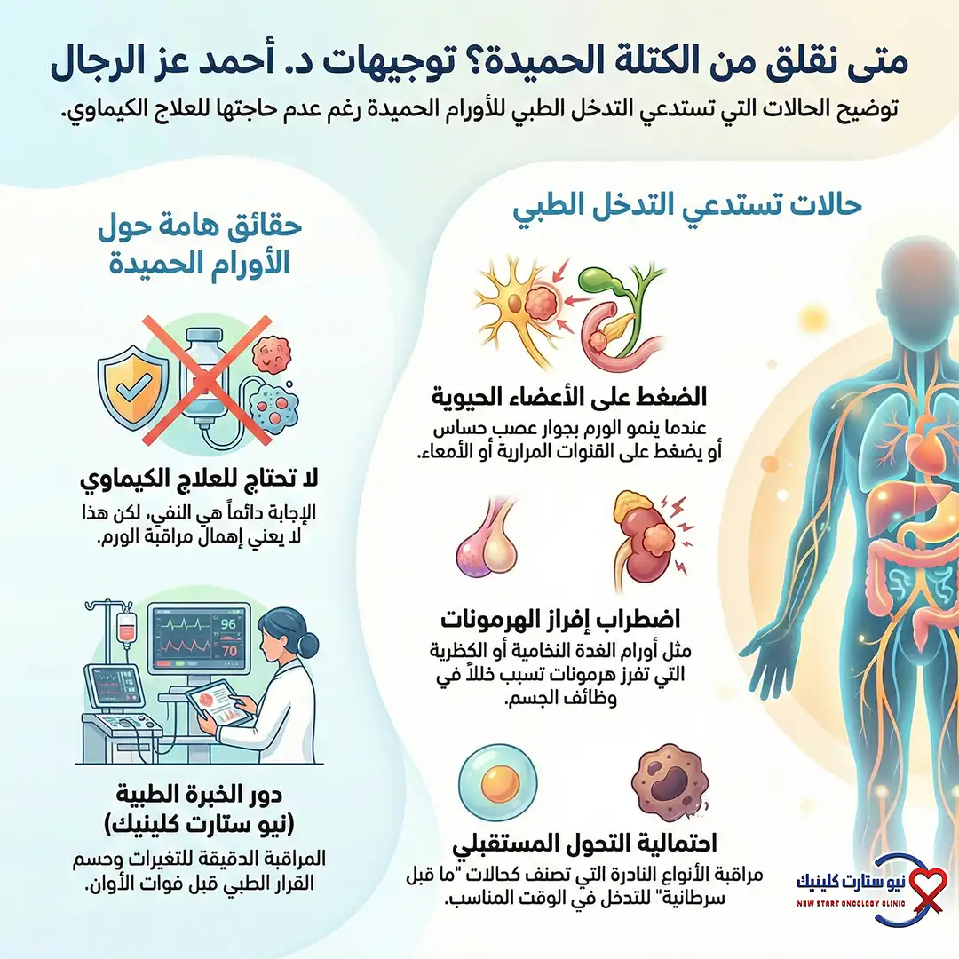 هل الورم الحميد يحتاج كيماوي