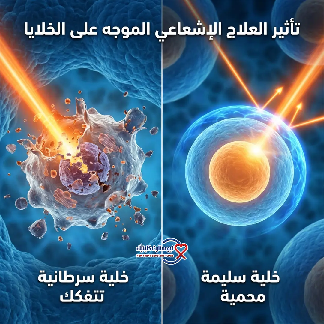 هل العلاج الإشعاعي يسبب الوفاة