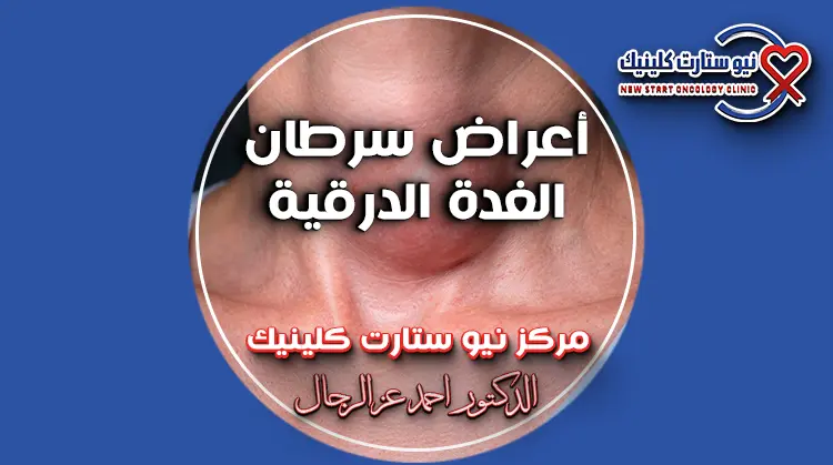 أعراض سرطان الغدة الدرقية