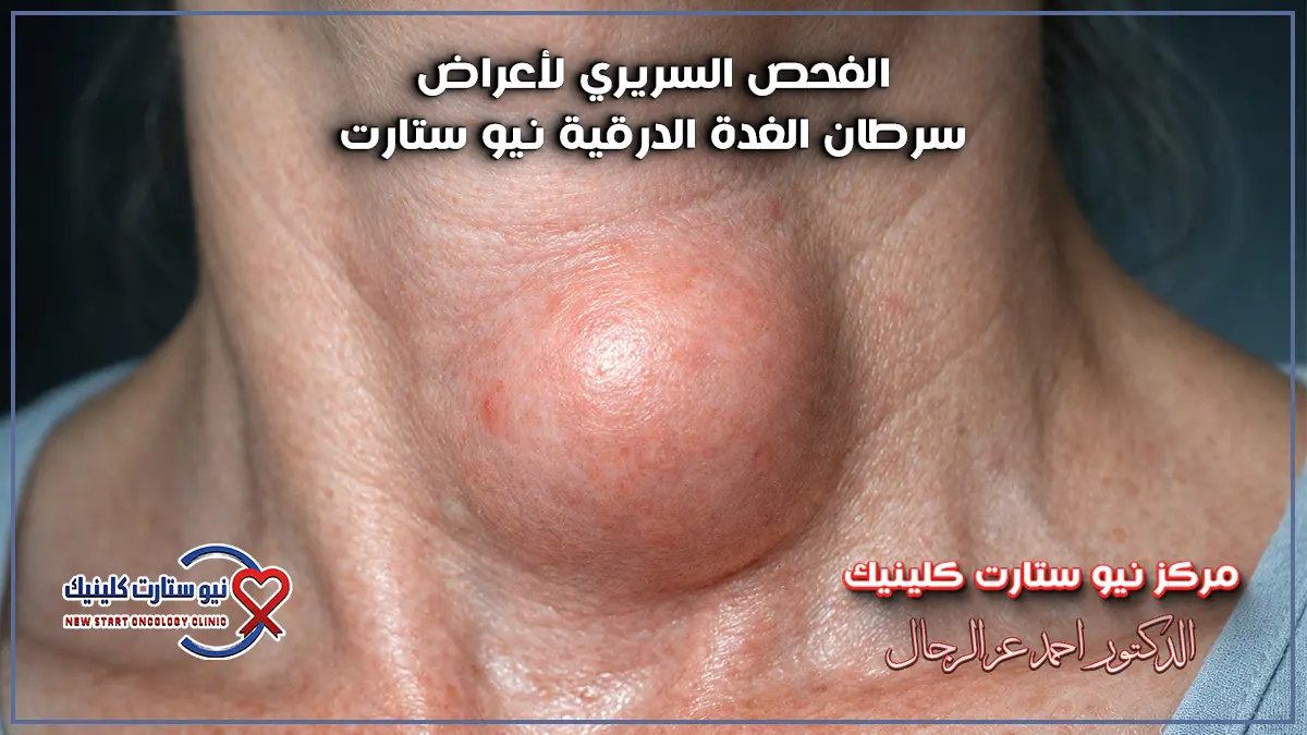 أعراض سرطان الغدة الدرقية