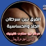 الفرق بين سرطان الجلد والحساسية