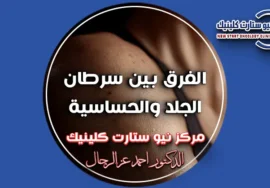 الفرق بين سرطان الجلد والحساسية