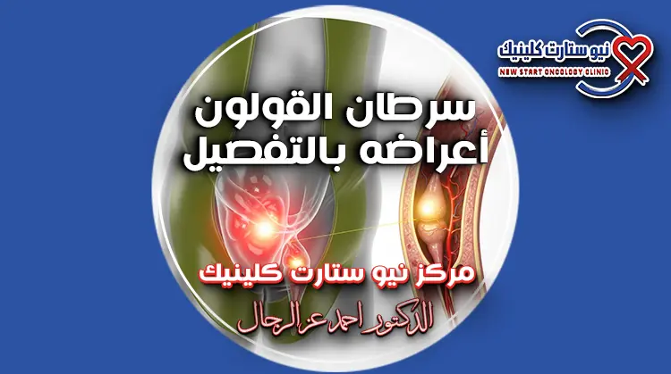 سرطان القولون