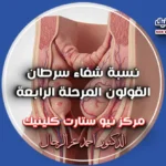 نسبة شفاء سرطان القولون المرحلة الرابعة