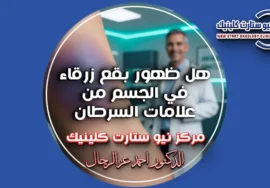 هل ظهور بقع زرقاء في الجسم من علامات السرطان