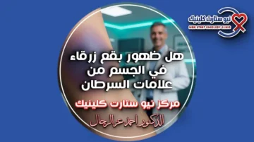 هل ظهور بقع زرقاء في الجسم من علامات السرطان
