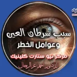 سبب سرطان العين