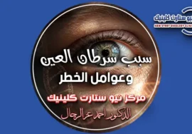 سبب سرطان العين