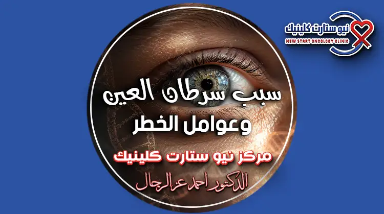 سبب سرطان العين
