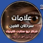 علامات سرطان العين