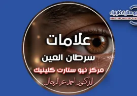 علامات سرطان العين