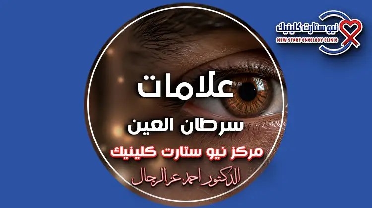 علامات سرطان العين