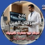 علاج سرطان العين بالطب النووي في مركز نيو ستارت كلينيك