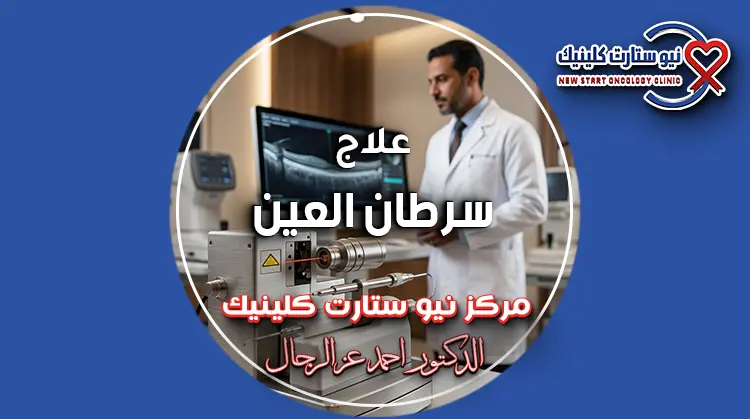 علاج سرطان العين بالطب النووي في مركز نيو ستارت كلينيك