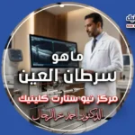 ماهو سرطان العين وشرح طبيعة كانسر العين علمياً.