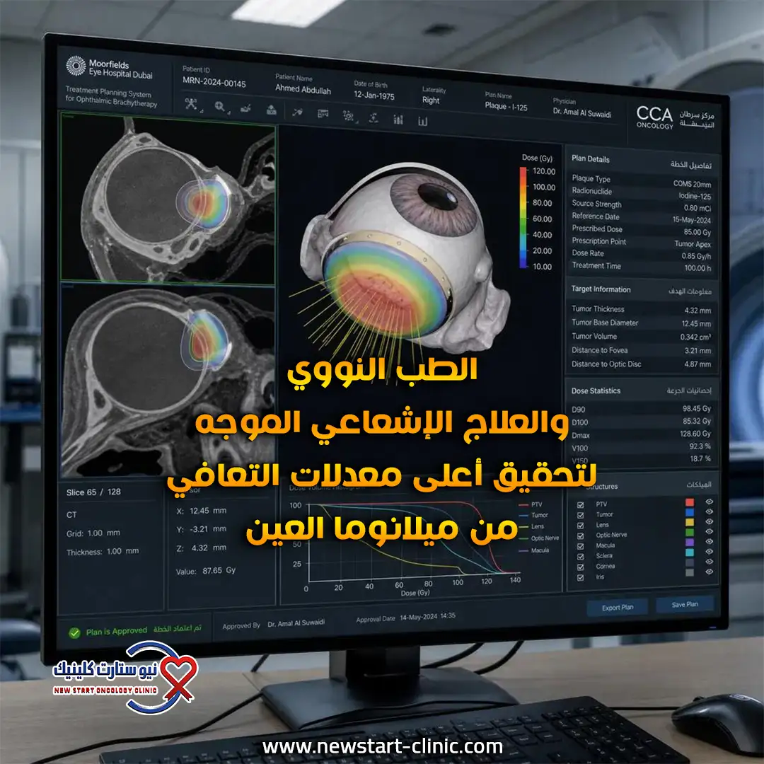 تقنيات الطب النووي والعلاج الإشعاعي الموجه لتحقيق أعلى معدلات التعافي من ميلانوما العين.