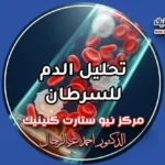 تحليل الدم للسرطان وفحص خلايا اللوكيميا في المختبر.