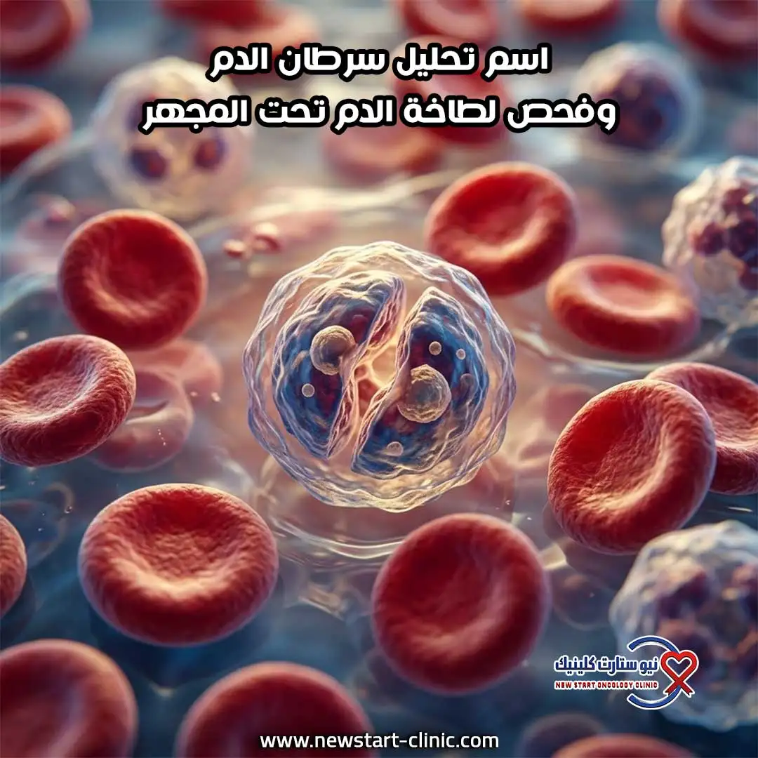 اسم تحليل سرطان الدم وفحص لطاخة الدم تحت المجهر.