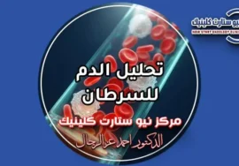 تحليل الدم للسرطان وفحص خلايا اللوكيميا في المختبر.