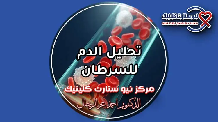 تحليل الدم للسرطان وفحص خلايا اللوكيميا في المختبر.