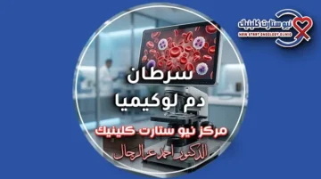 سرطان دم لوكيميا والدليل الطبي الشامل للأنواع والمراحل في مركز نيو ستارت.