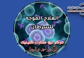 العلاج الموجه للسرطان أنواعه وجرعاته وأحدث بروتوكولات الأورام بمركز نيو ستارت كلينيك