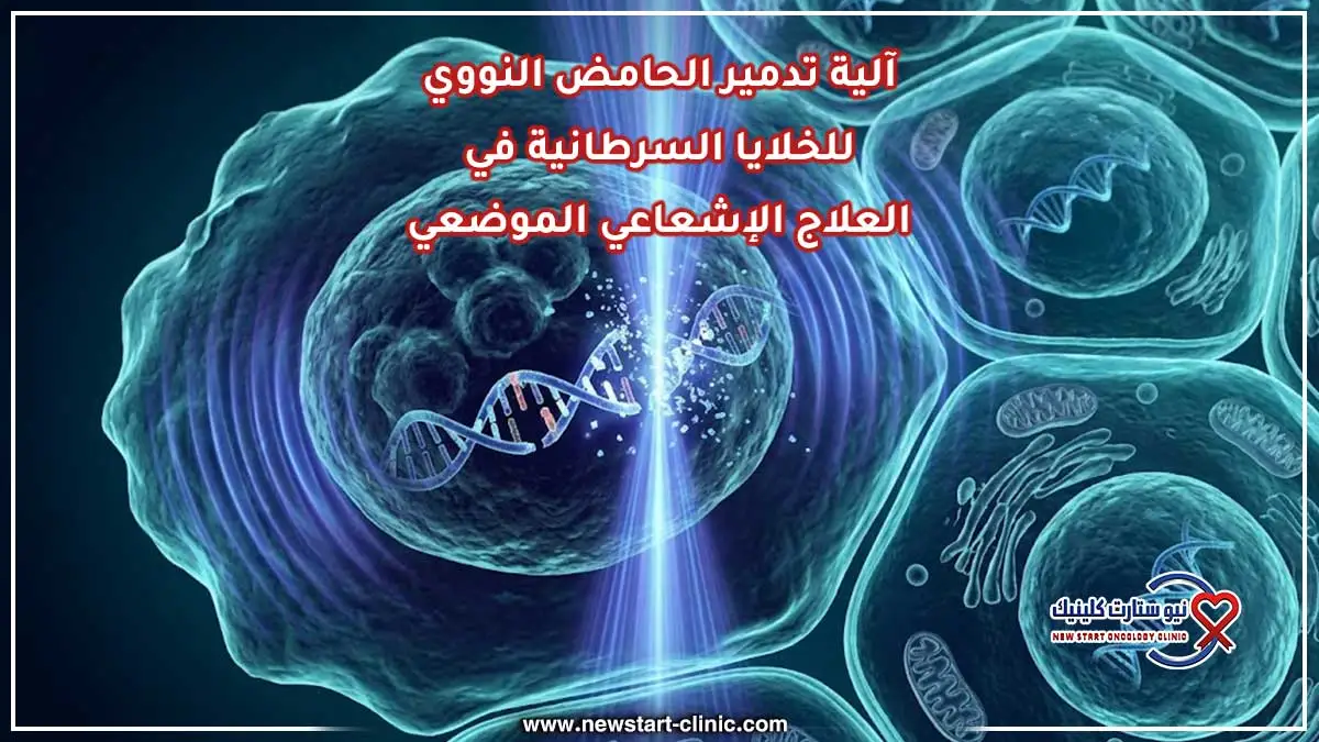 آلية تدمير الحامض النووي للخلايا السرطانية في العلاج الإشعاعي الموضعي