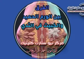 الفرق بين الورم الحميد والخبيث في الثدي العلامات والفحوصات بمركز نيو ستارت كلينيك