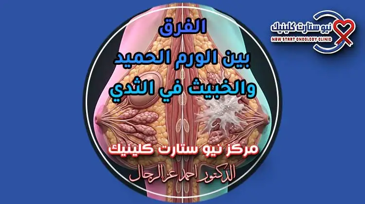الفرق بين الورم الحميد والخبيث في الثدي العلامات والفحوصات بمركز نيو ستارت كلينيك