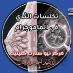 تكلسات الثدي في الماموجرام متى تكون حميدة ومتى تشير لورم بمركز نيو ستارت كلينيك