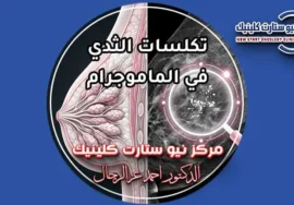 تكلسات الثدي في الماموجرام متى تكون حميدة ومتى تشير لورم بمركز نيو ستارت كلينيك