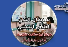 سرطان الثدي الثلاثي السلبي أحدث بروتوكولات العلاج ونسب الشفاء بمركز نيو ستارت كلينيك