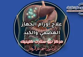 أحدث بروتوكولات علاج أورام الجهاز الهضمي والكبد بالعلاج الموجه والأدوية البيولوجية الذكية