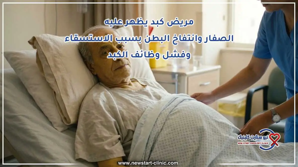مريض كبد يظهر عليه الصفار وانتفاخ البطن بسبب الاستسقاء وفشل وظائف الكبد
