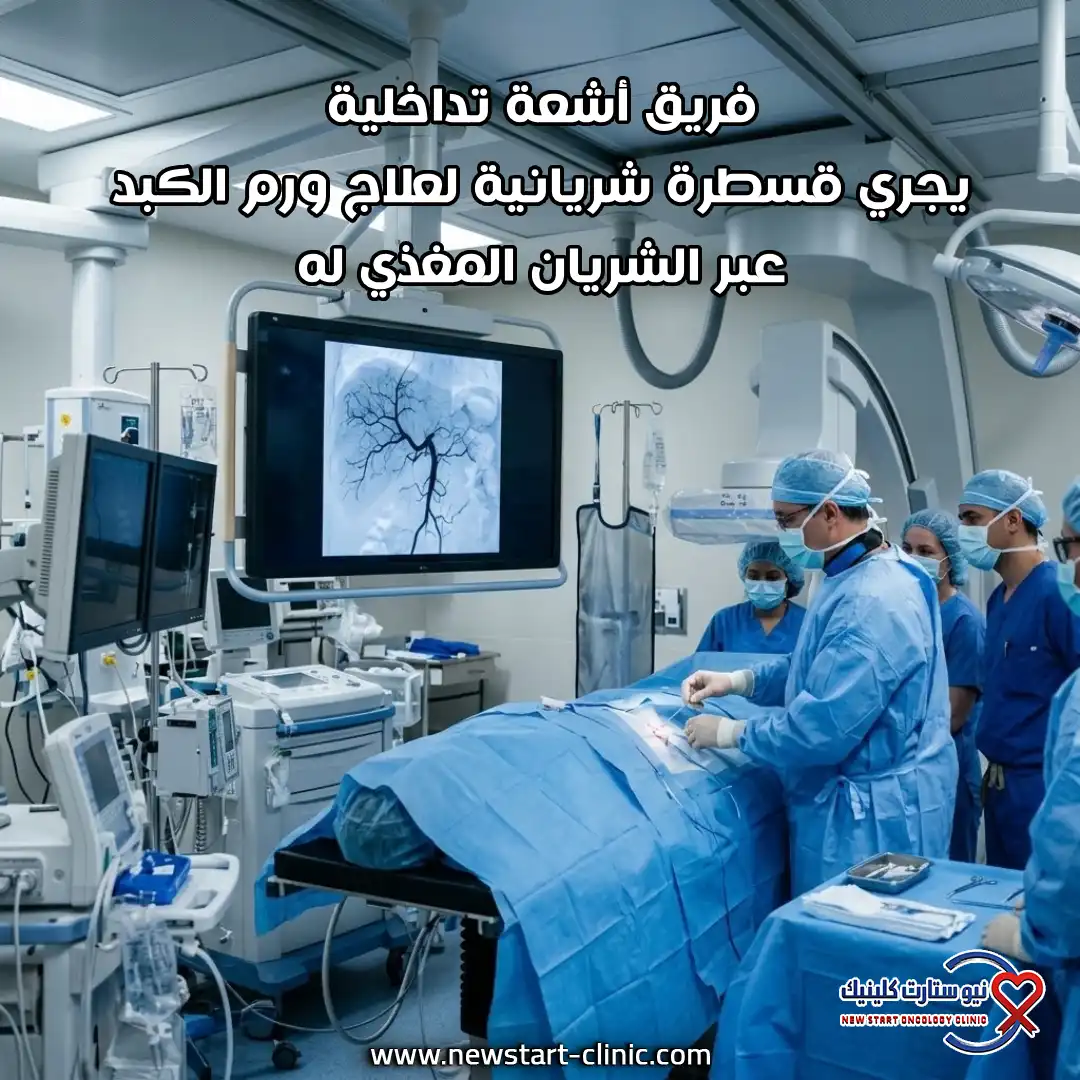 فريق أشعة تداخلية يجري قسطرة شريانية لعلاج ورم الكبد عبر الشريان المغذي له