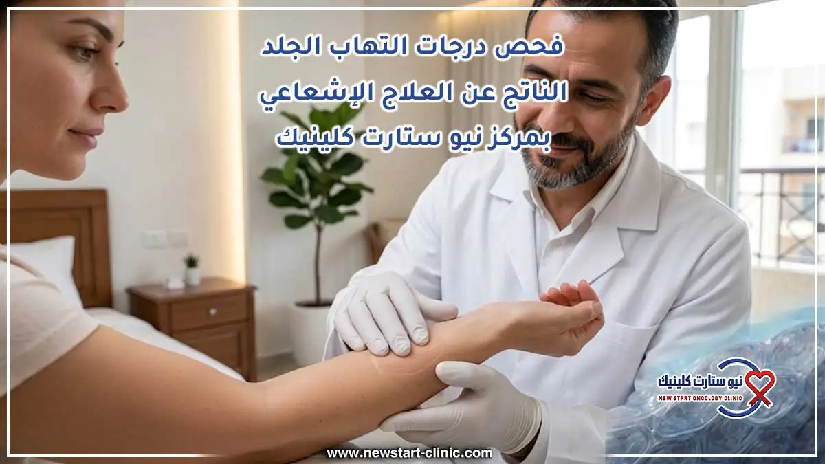 فحص درجات التهاب الجلد الناتج عن العلاج الإشعاعي بمركز نيو ستارت كلينيك