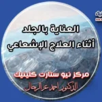 العناية بالجلد أثناء العلاج الإشعاعي والوقاية من الحروق بمركز نيو ستارت كلينيك د. أحمد عز الرجال