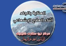 العناية بالجلد أثناء العلاج الإشعاعي والوقاية من الحروق بمركز نيو ستارت كلينيك د. أحمد عز الرجال