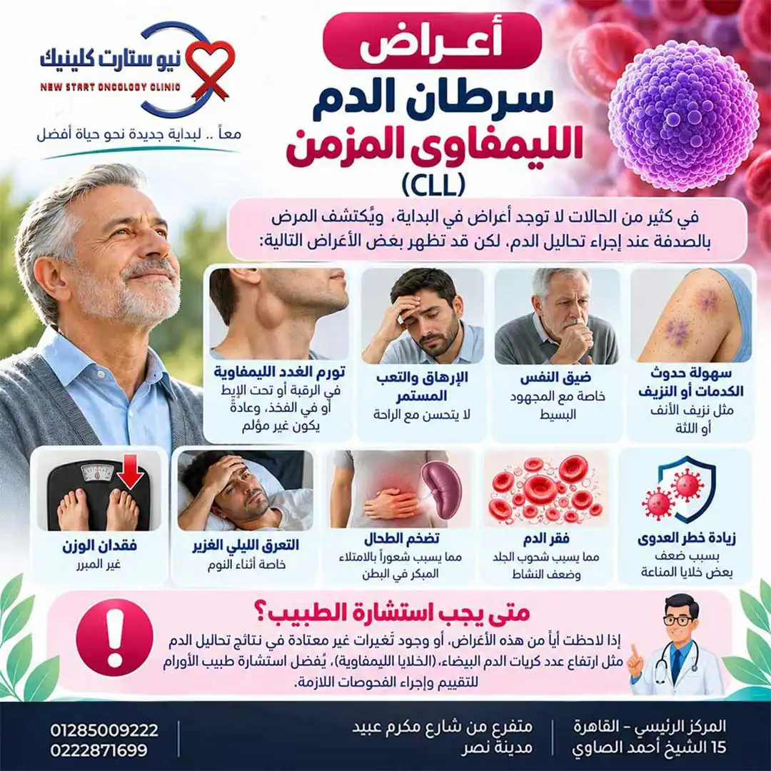 أعراض سرطان الدم الليمفاوي المزمن وتضخم الغدد بمركز نيو ستارت كلينيك د. أحمد عز الرجال