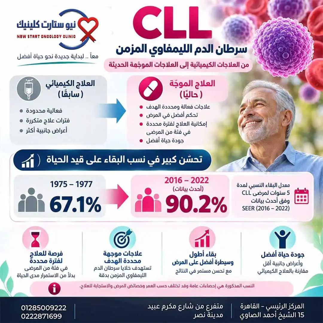 تطور علاج سرطان الدم الليمفاوي المزمن ونسب البقاء بمركز نيو ستارت كلينيك