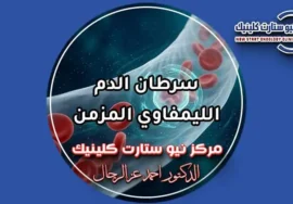 سرطان الدم الليمفاوي المزمن وخيارات العلاج الموجه بمركز نيو ستارت كلينيك د. أحمد عز الرجال
