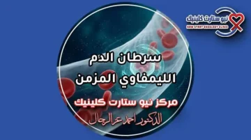 سرطان الدم الليمفاوي المزمن وخيارات العلاج الموجه بمركز نيو ستارت كلينيك د. أحمد عز الرجال