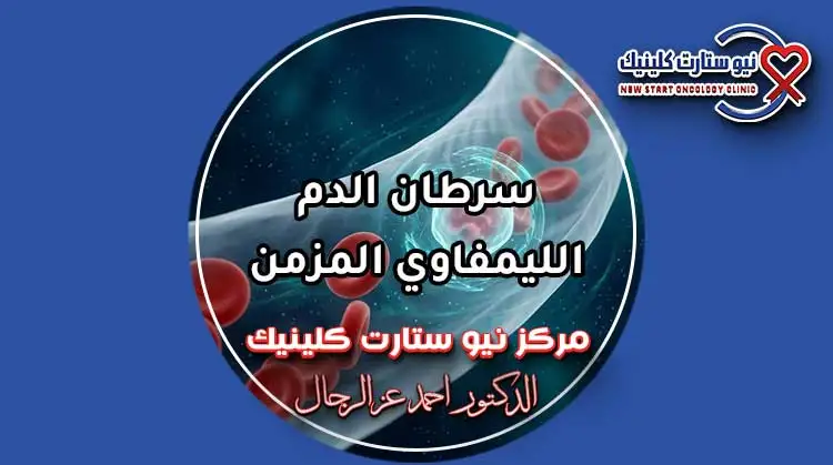 سرطان الدم الليمفاوي المزمن وخيارات العلاج الموجه بمركز نيو ستارت كلينيك د. أحمد عز الرجال