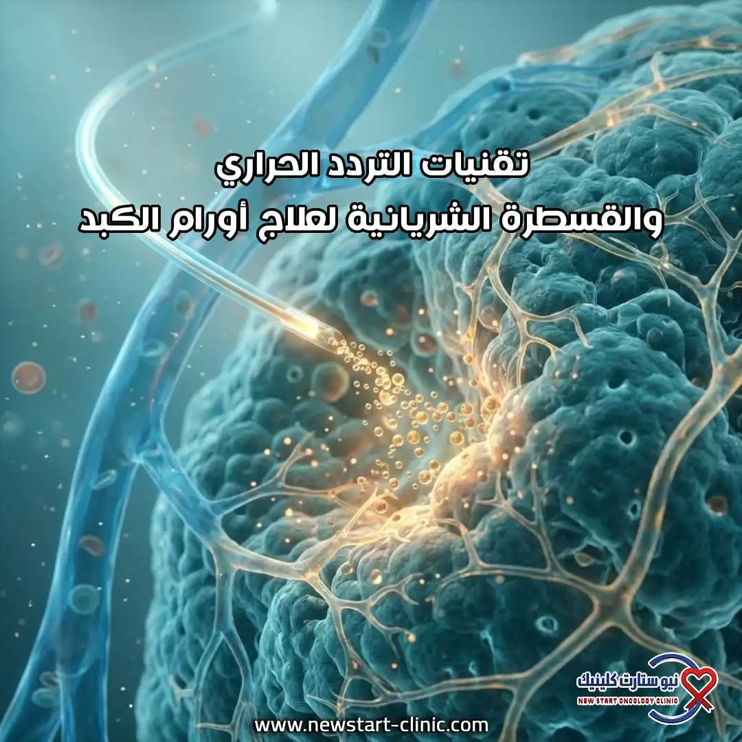 تقنيات التردد الحراري والقسطرة الشريانية لعلاج أورام الكبد