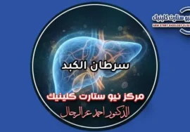 دليل سرطان الكبد وخيارات العلاج الحديثة بمركز نيو ستارت دكتور أحمد عز الرجال
